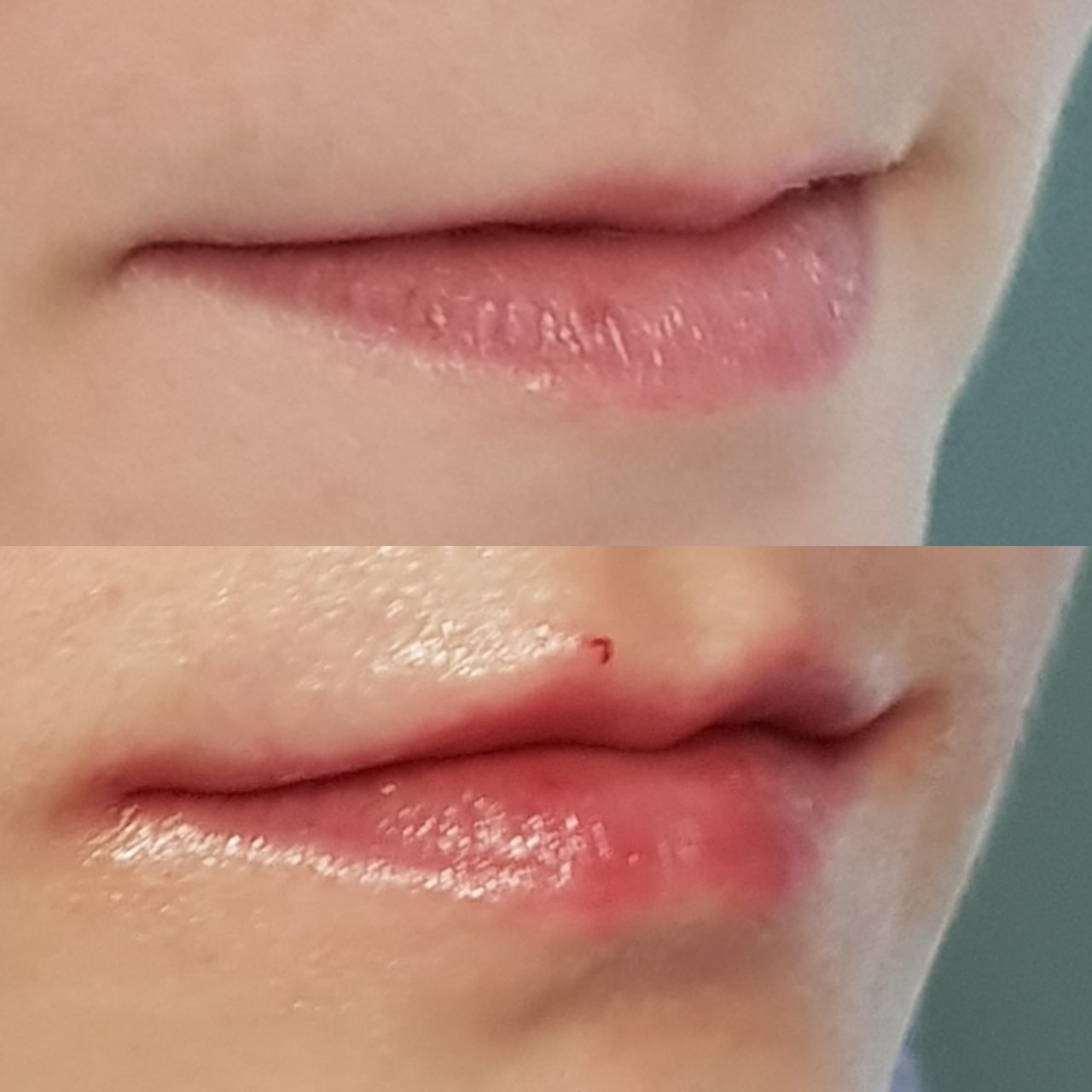 Rosalba Herrero Zerpa-205