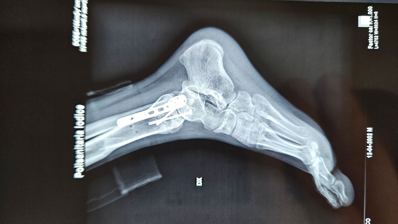 Gennaro Campopiano-14