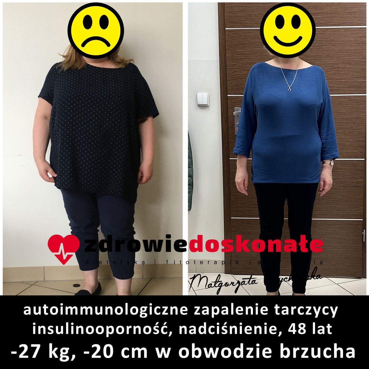 Małgorzata Zychalska-74