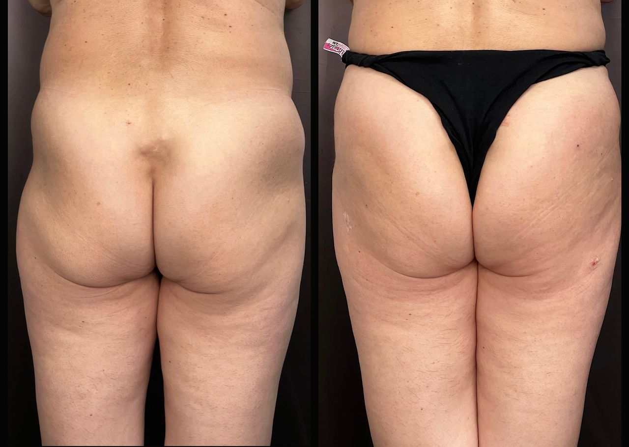 Salvatore Battaglia-9