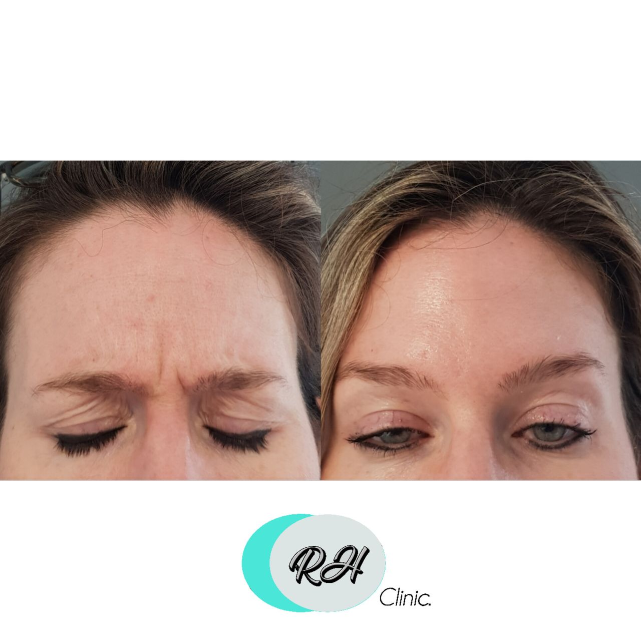 Rosalba Herrero Zerpa-70