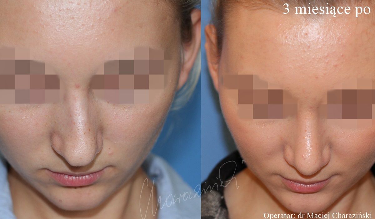 Maciej Charaziński-55