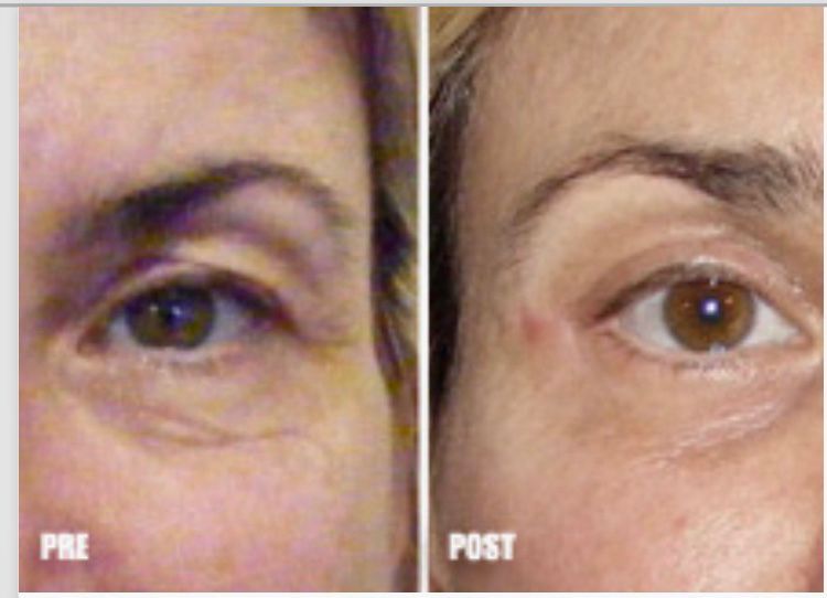 Pasquale Virciglio-20