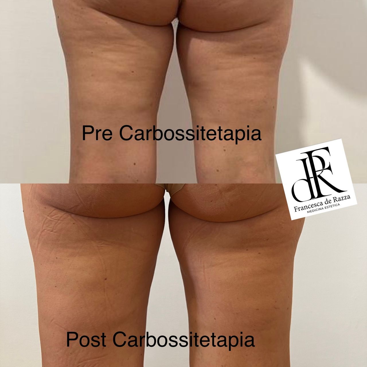 Francesca De Razza-61