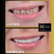 Edgar Teddy Romero Pelaez-2