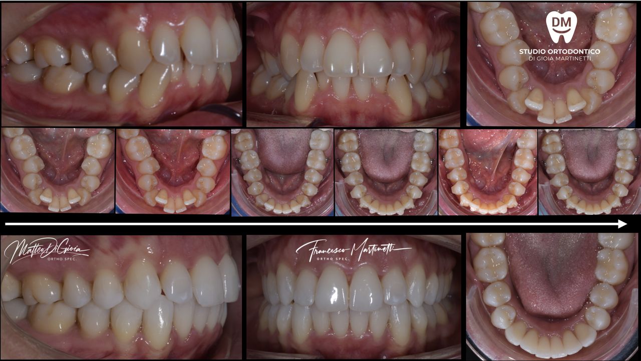 Francesco Martinetti-7