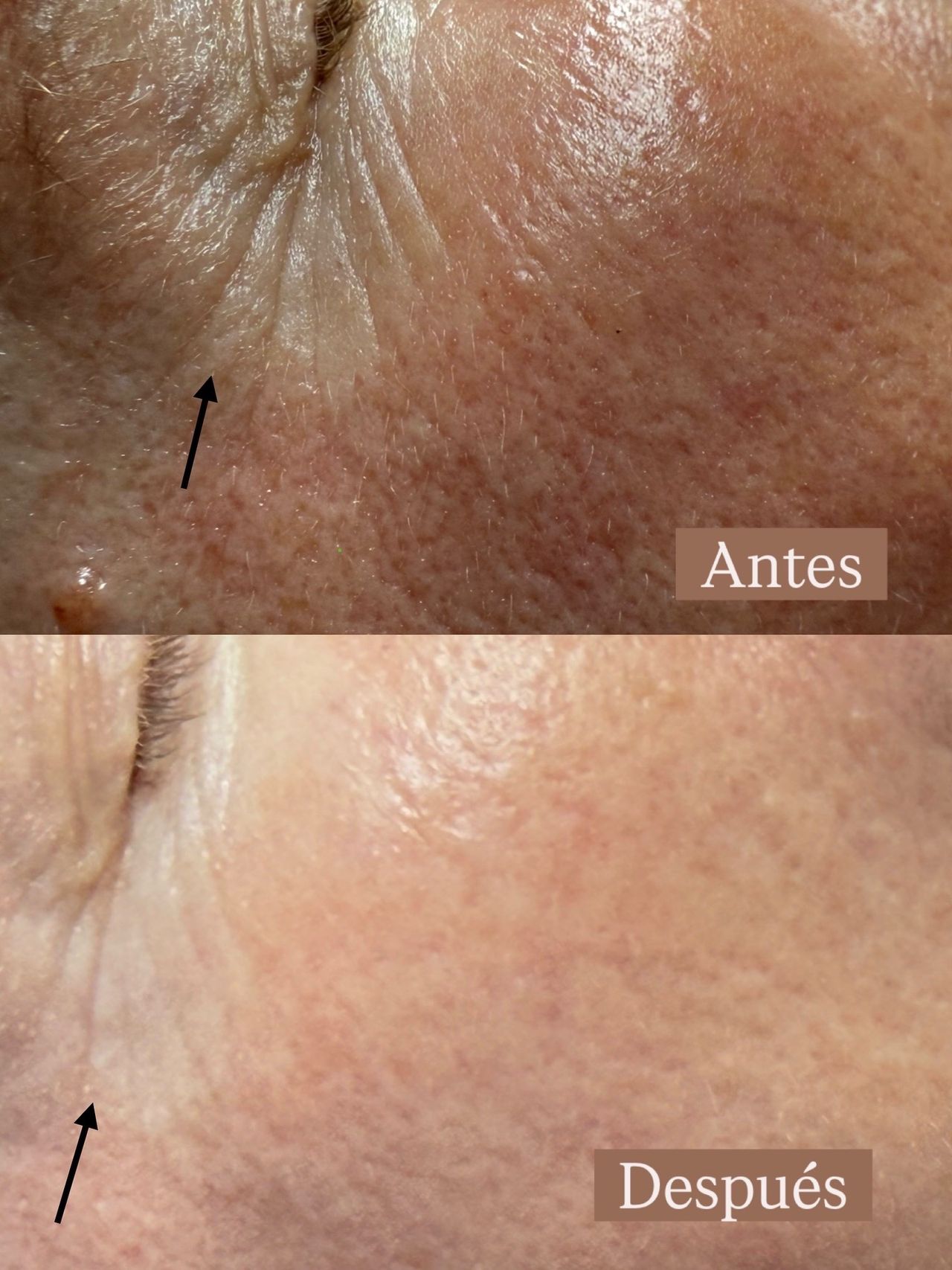 Àngels Nicolau Mesquida-0