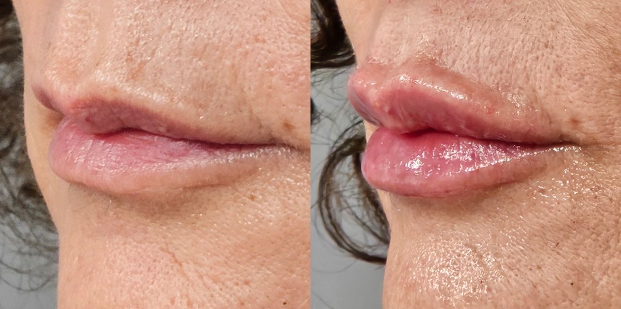 Rosalba Herrero Zerpa-542