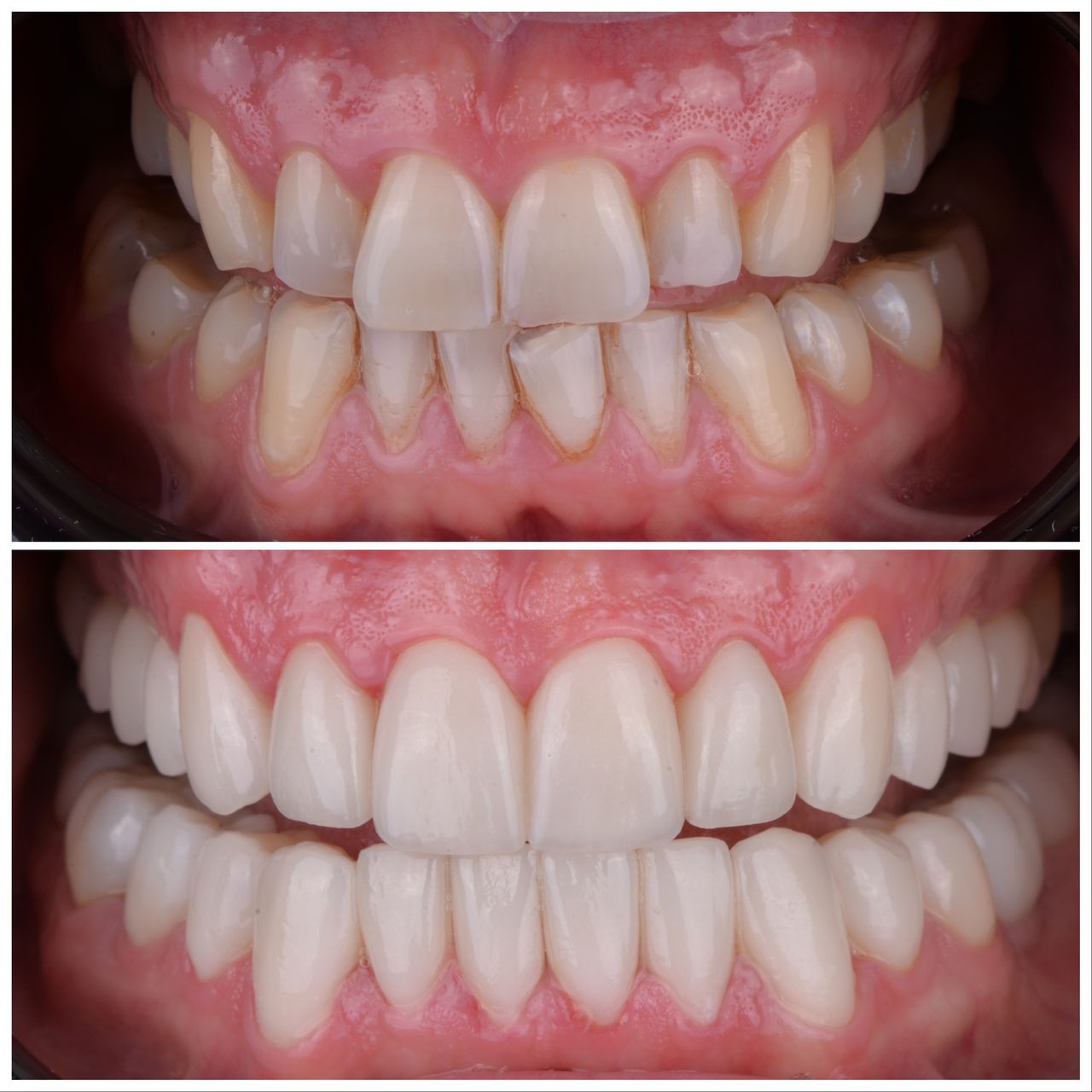 Martin Bartoszcze-29