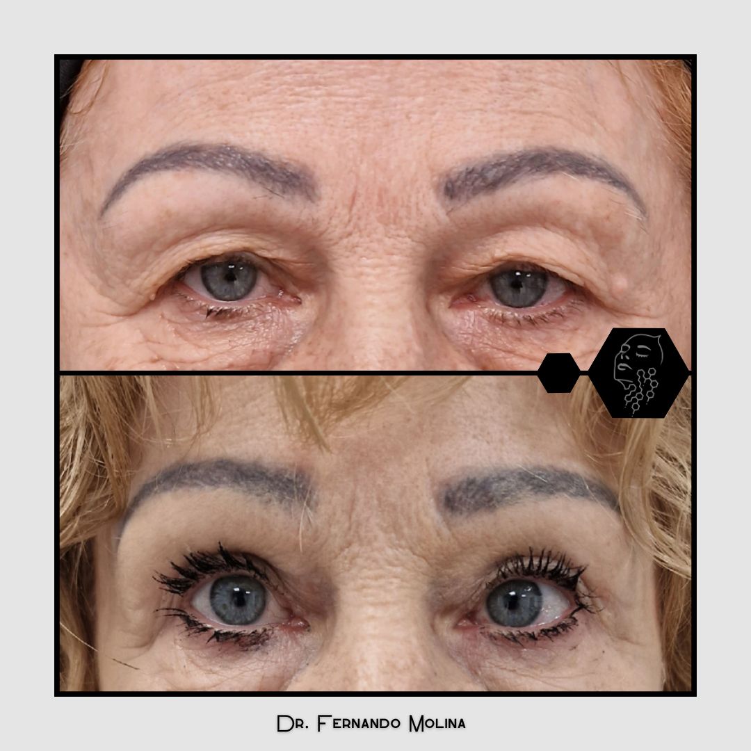 Fernando Molina Méndez-6