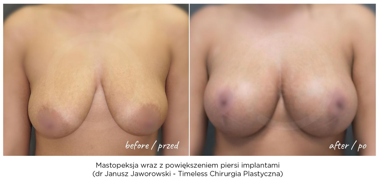 Janusz Jaworowski-50