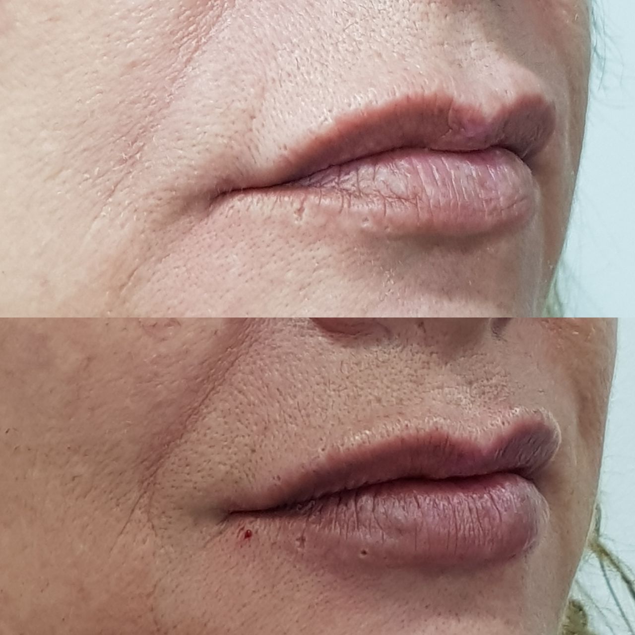 Rosalba Herrero Zerpa-243