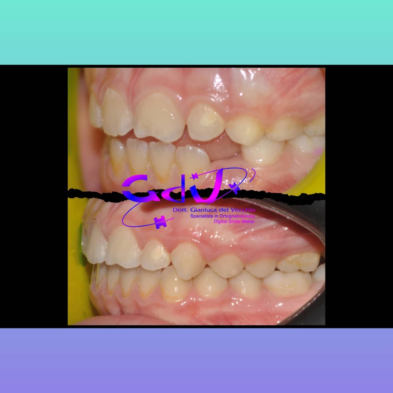 Gianluca Del Vecchio-154