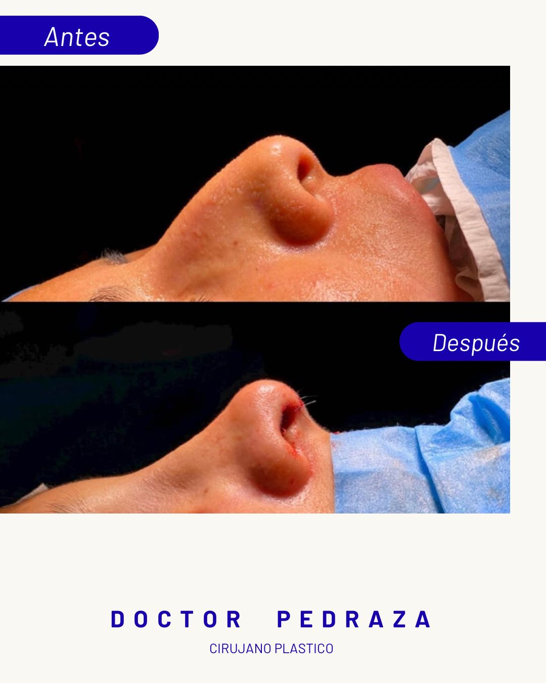 José María Pedraza Abad-4