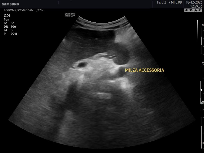 Gianluca Cisternino-20