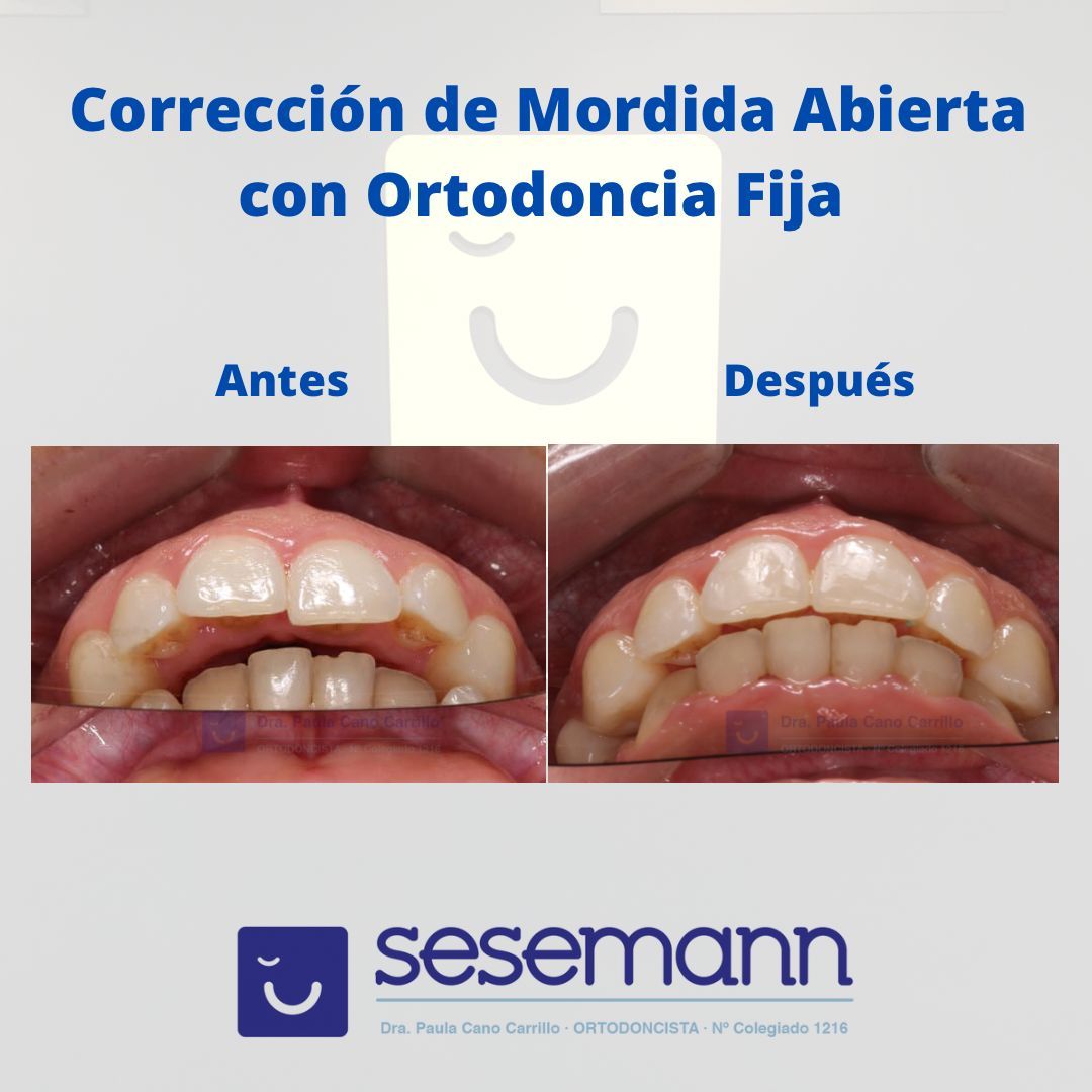 Paula Cano Carrillo-60