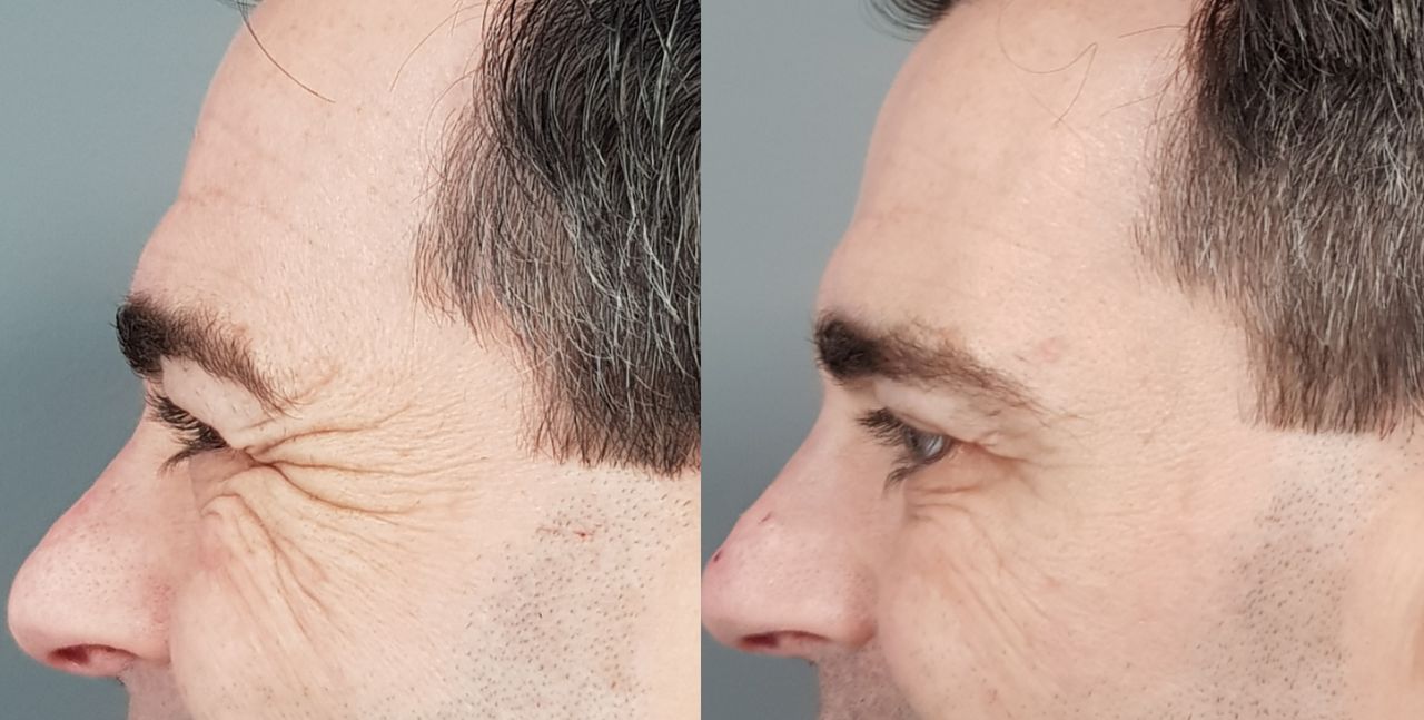 Rosalba Herrero Zerpa-151