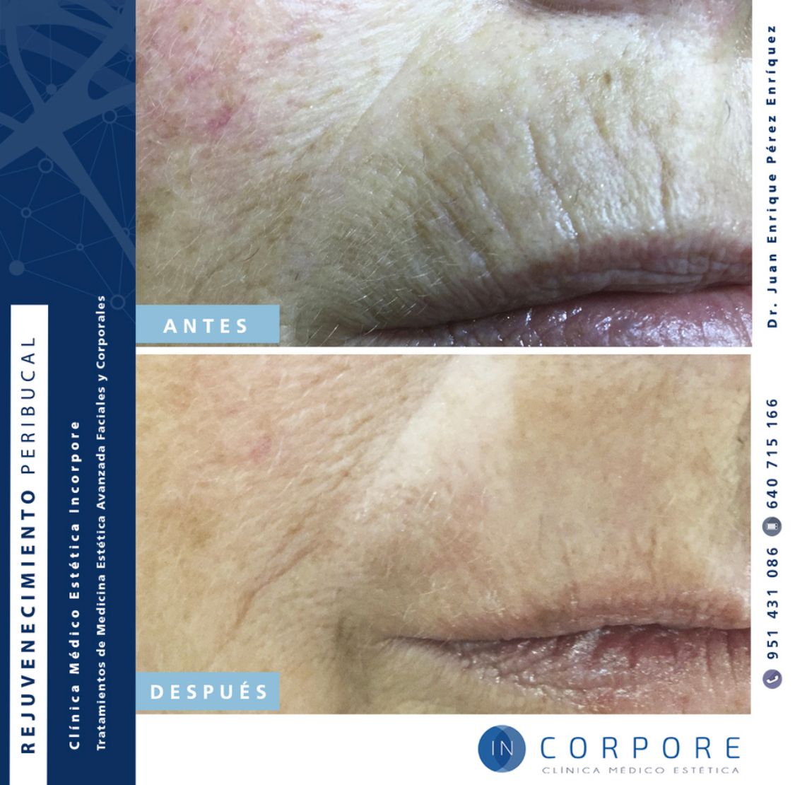 Juan Enrique Pérez Enríquez-64