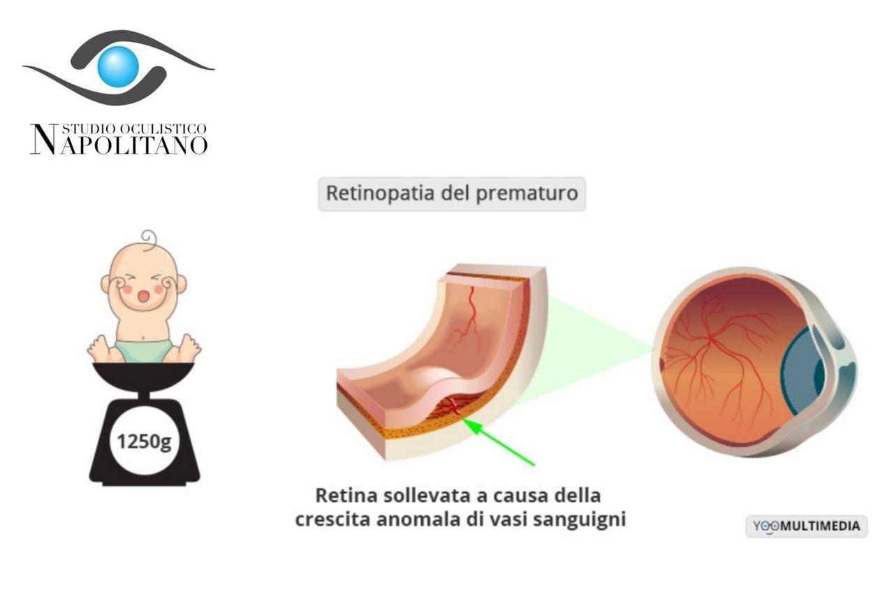 Pasquale Napolitano-20