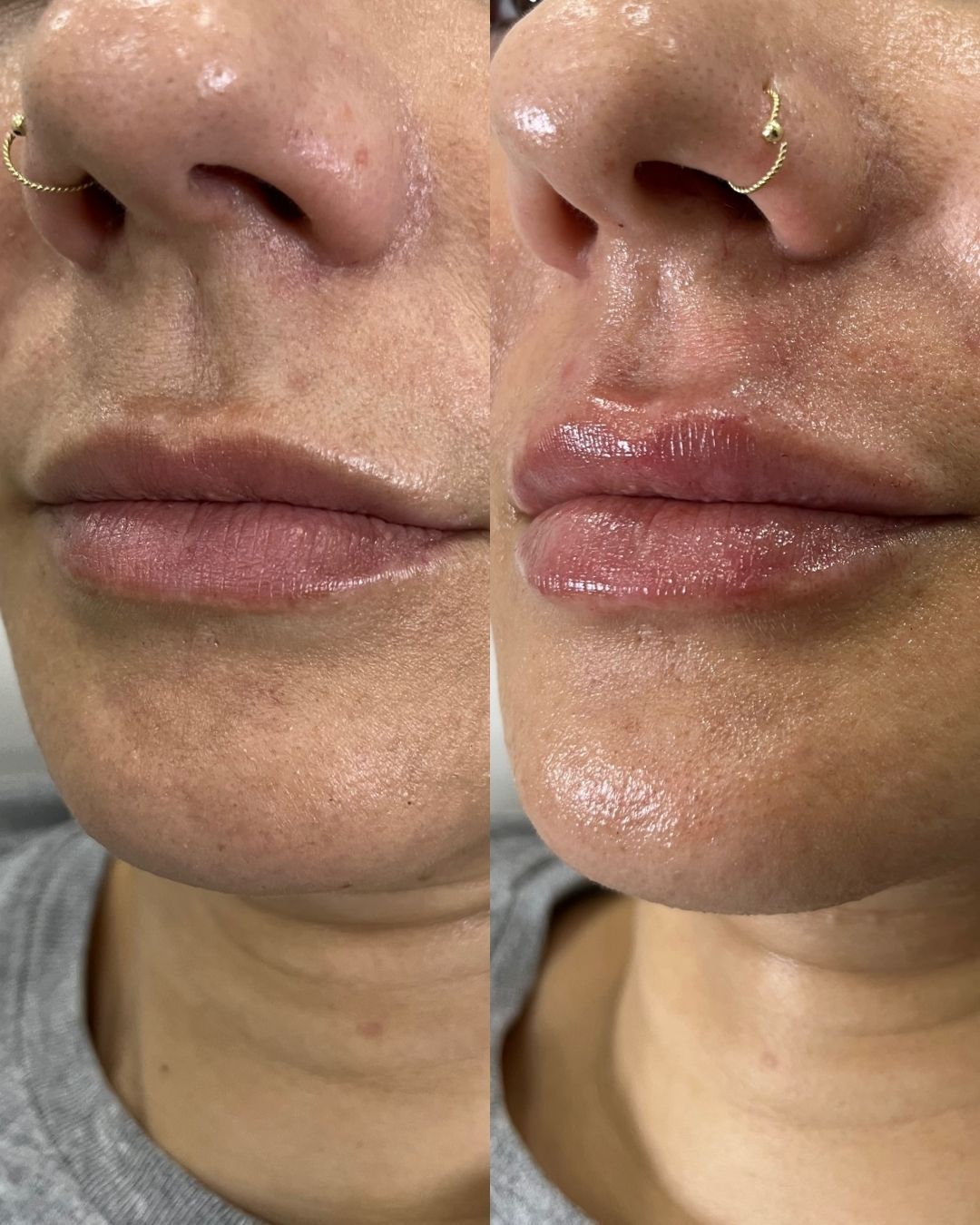 Juan Francisco Belén Montero-37