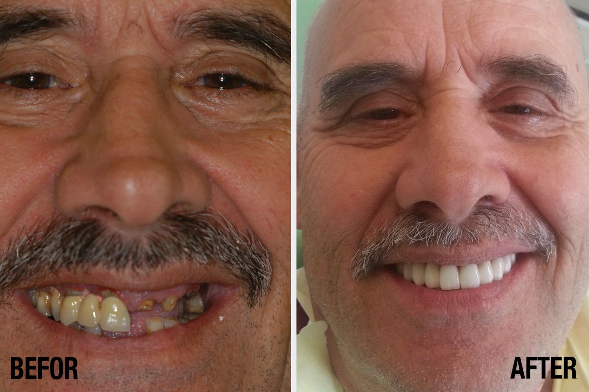 Alessandro Palumbo-28