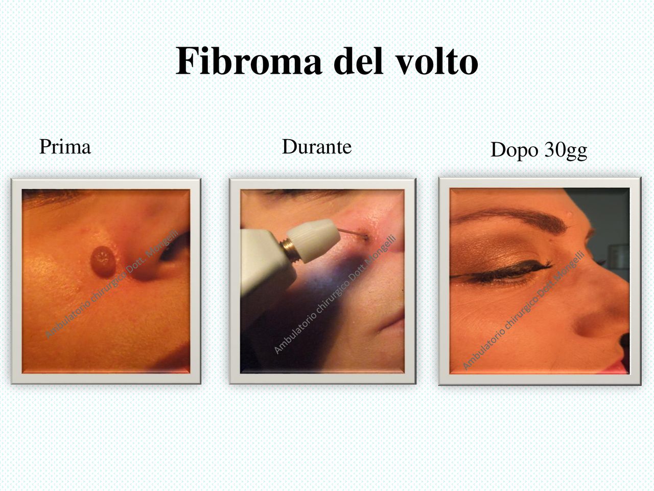 Matteo Antonio Mongelli-5