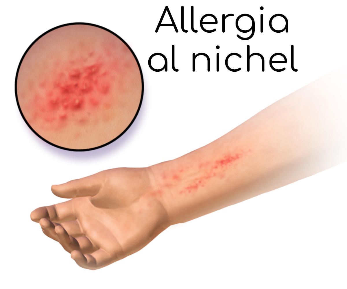 Giuseppe Pruiti Ciarello-7