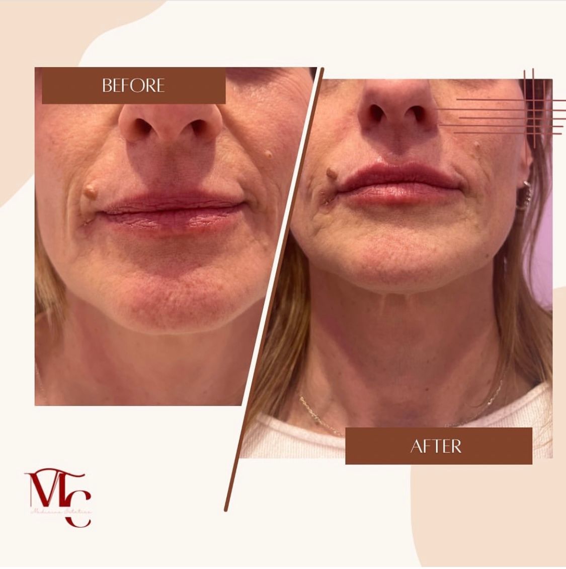 Maria Teresa Caragallo-3