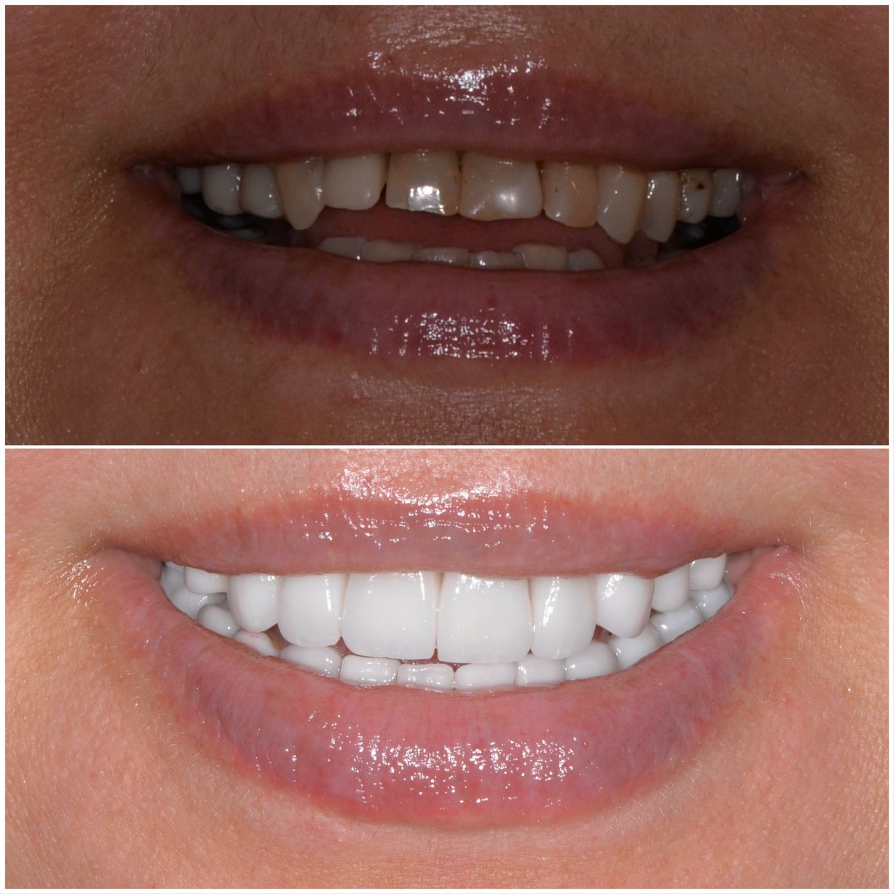 Martin Bartoszcze-13