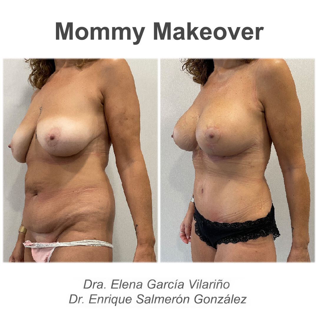 Enrique Salmerón González-59