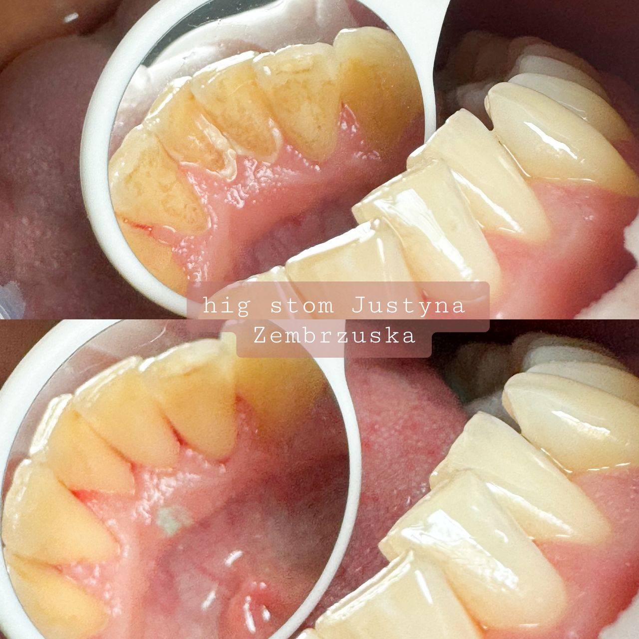 Justyna Zembrzuska-15