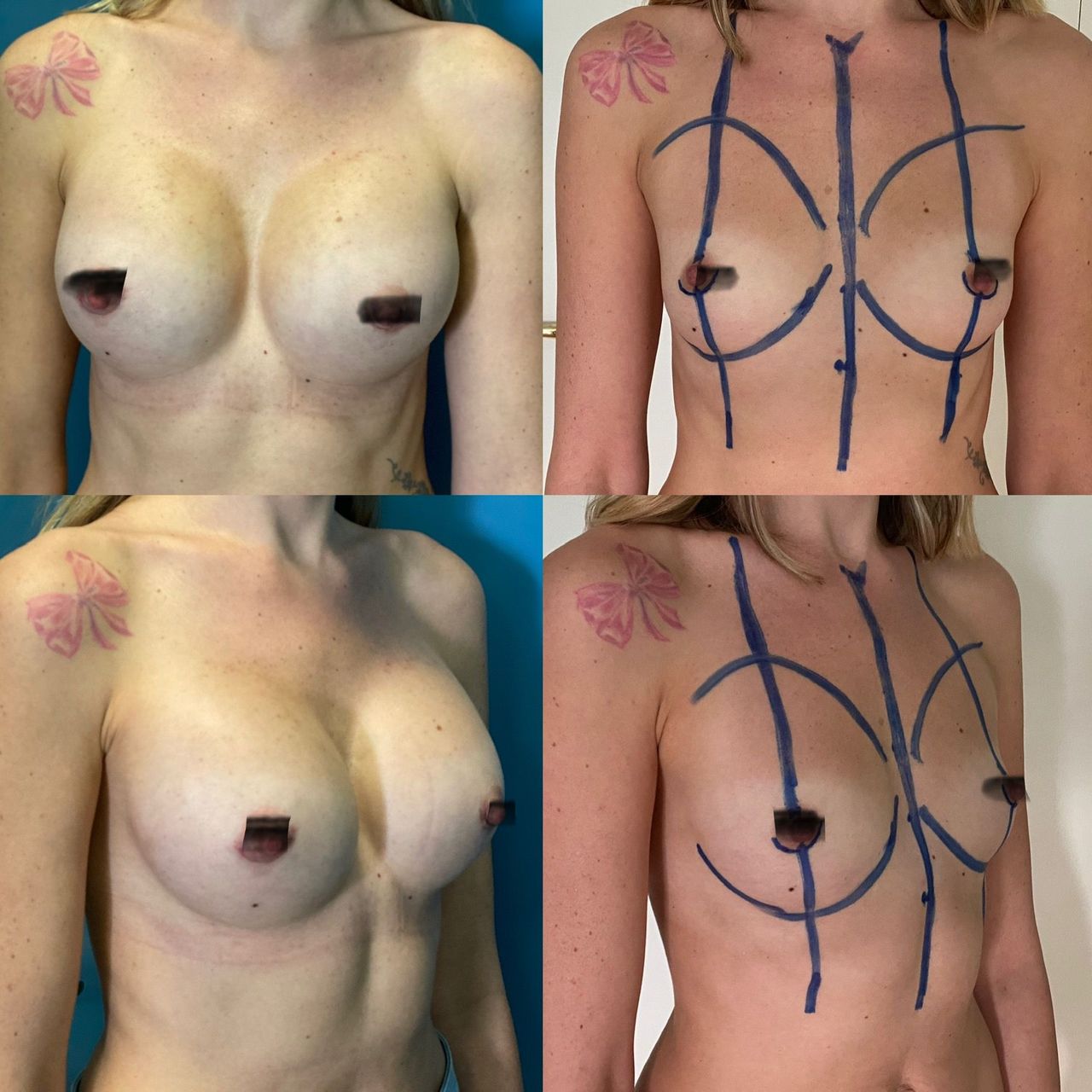 Pasquale Virciglio-39