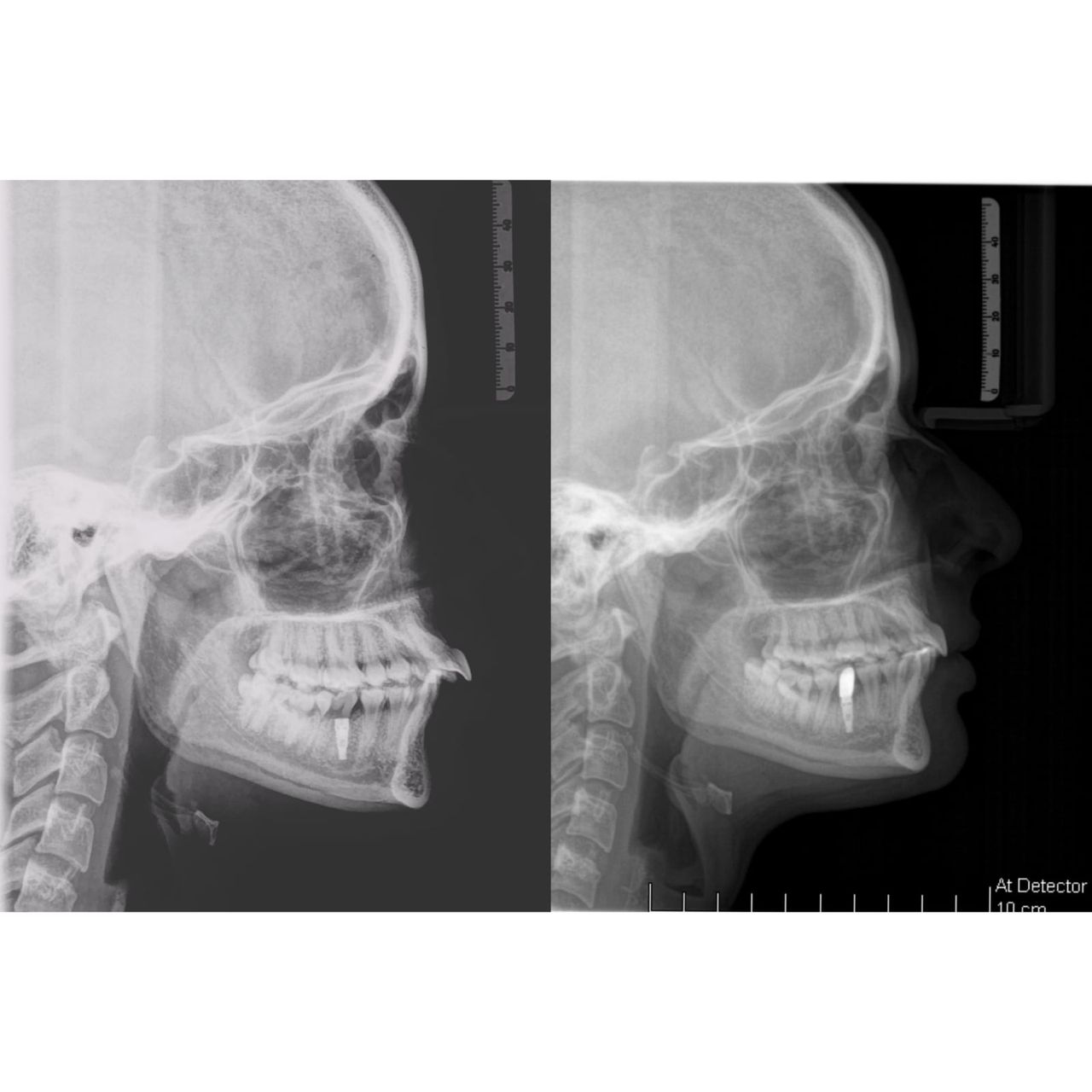 Gianluca Del Vecchio-163