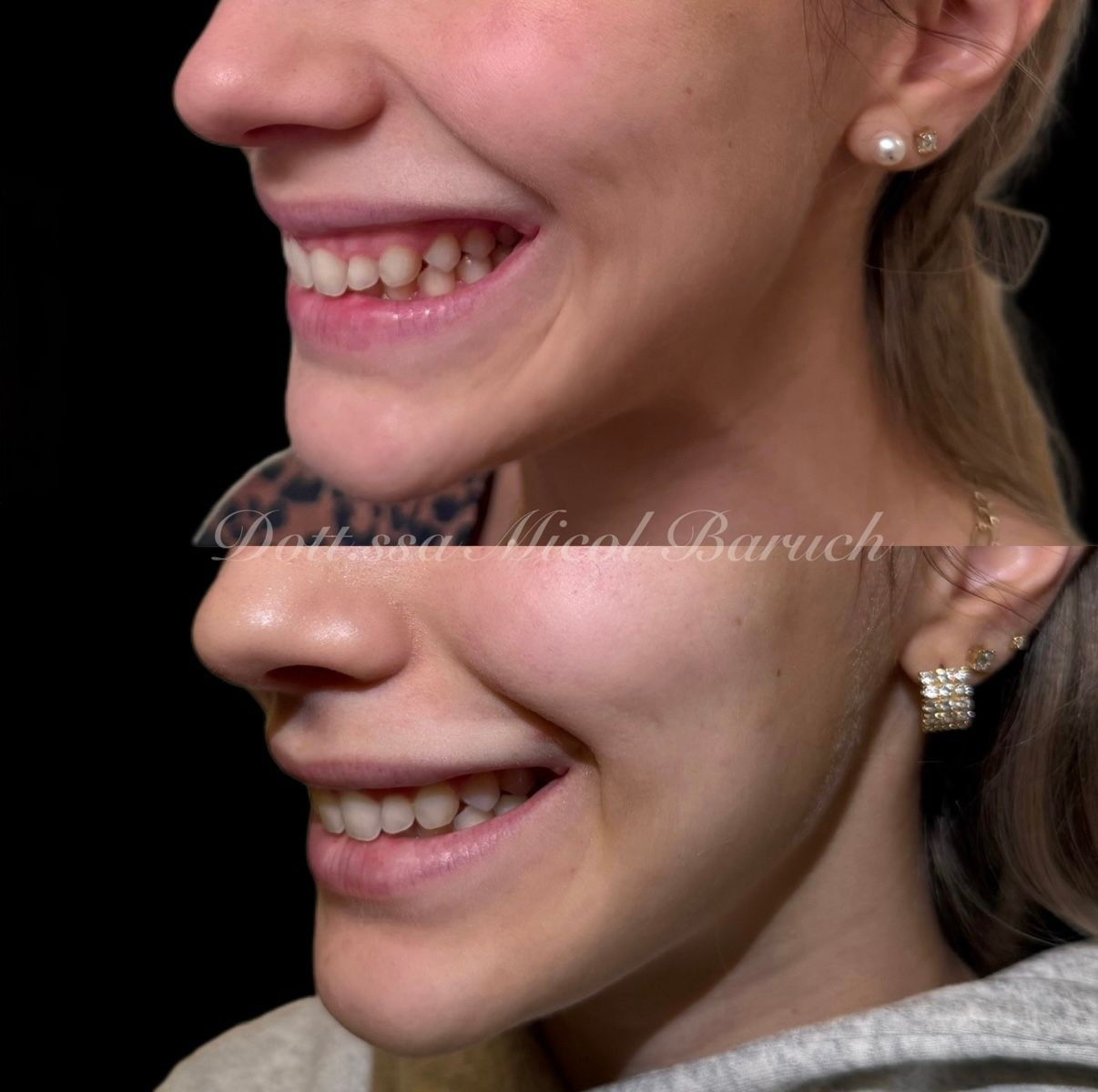 Micol Baruch-5