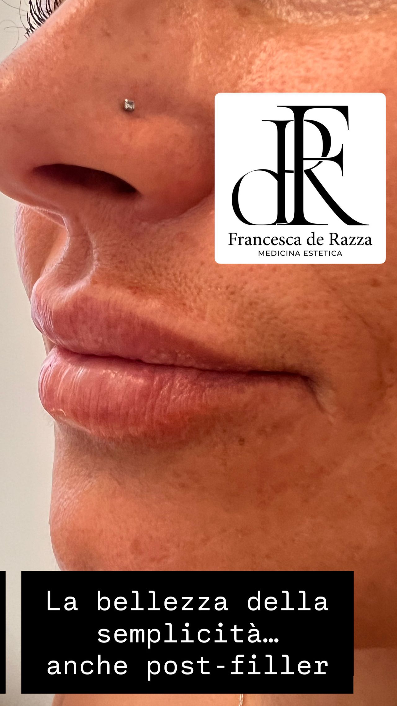Francesca De Razza-65