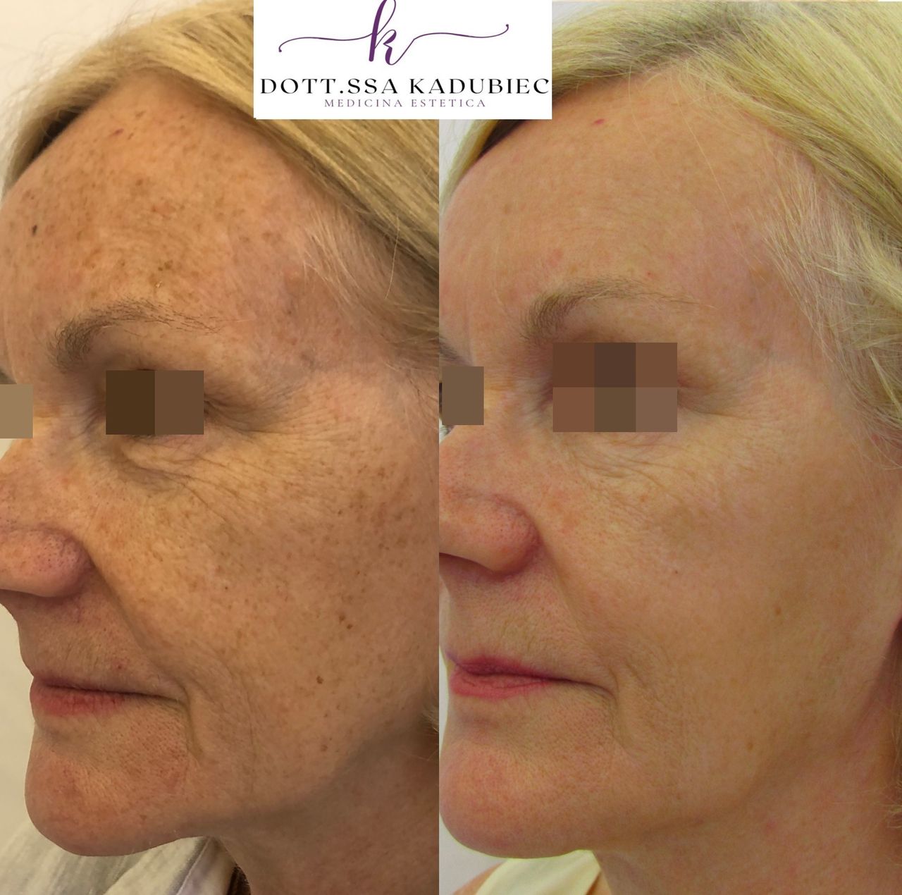 Aleksandra Kadubiec-9