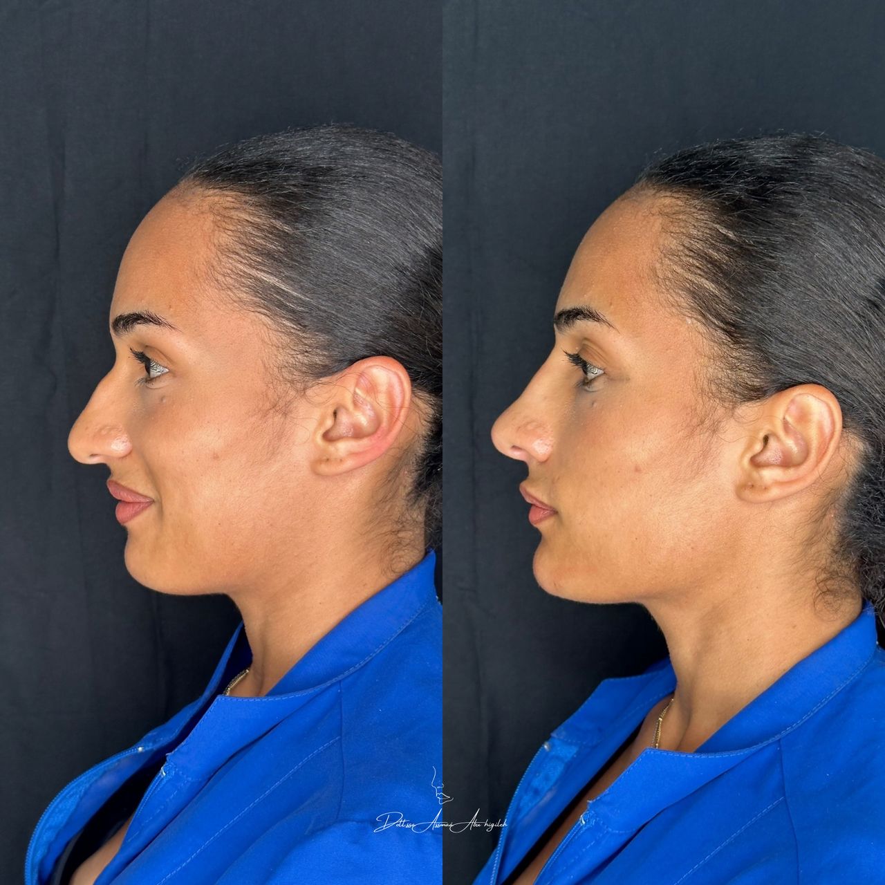 Assmaà Abu Higileh-1