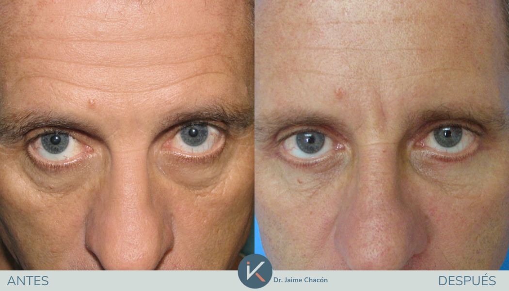 Jaime Eduardo Chacón Hernández-2