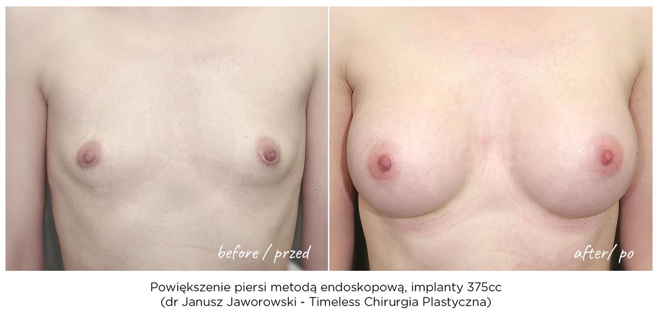 Janusz Jaworowski-153