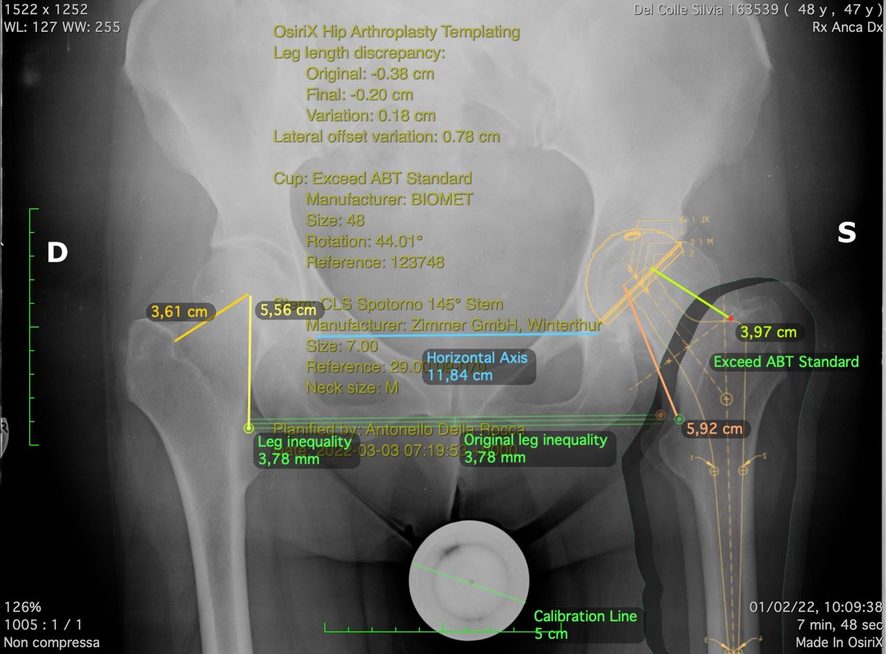 Antonello Della Rocca-17
