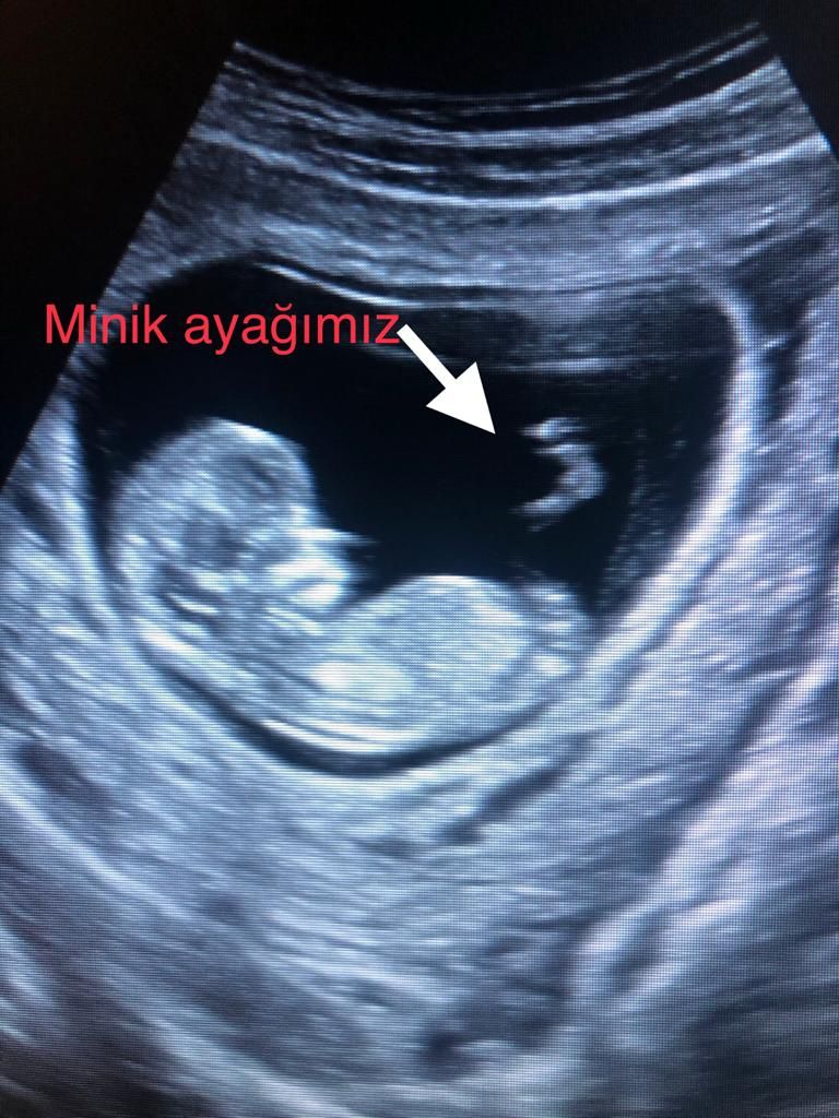 Dilek Turğut Kestane-9