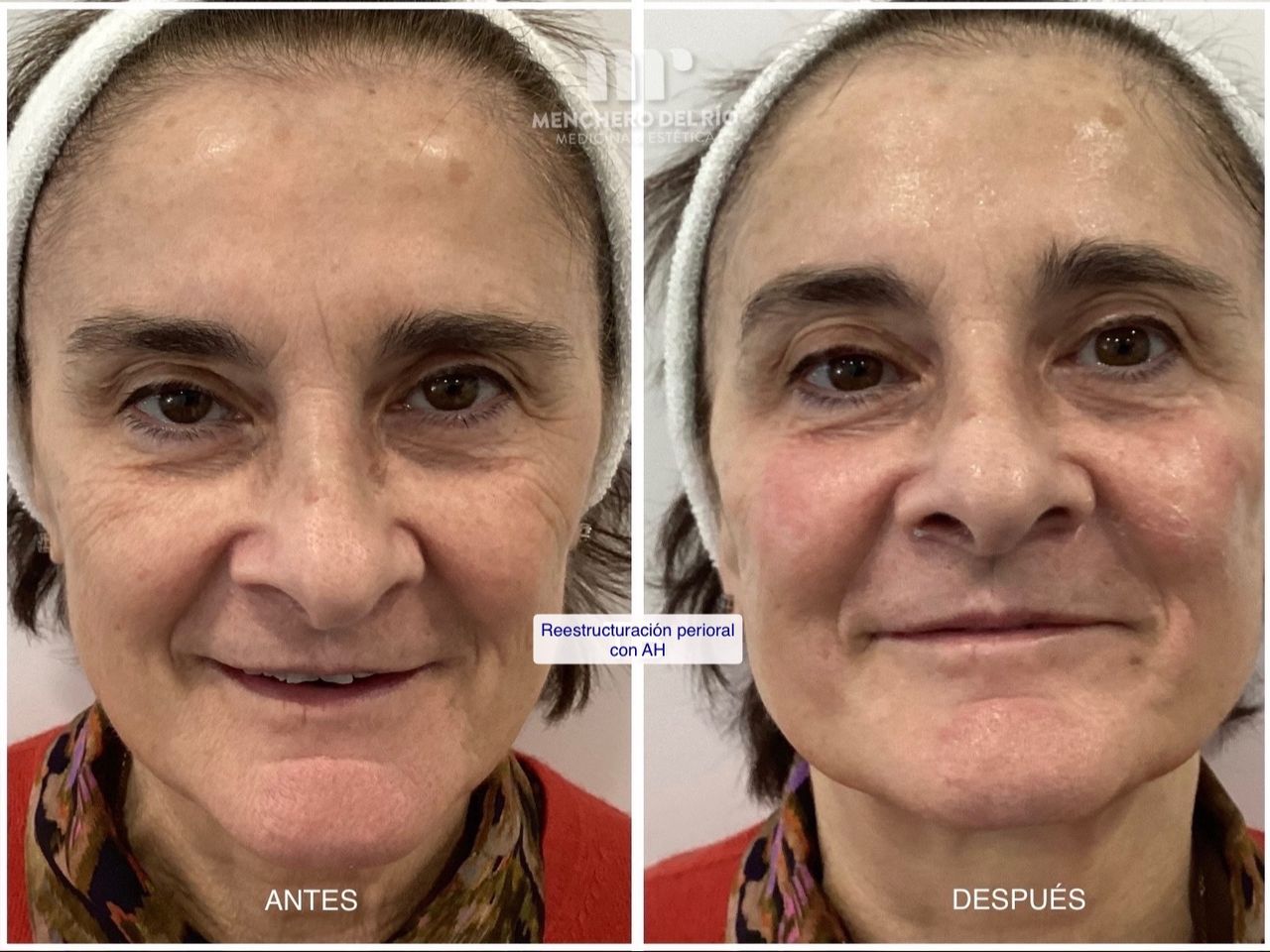 Arsenio Menchero Sánchez-8