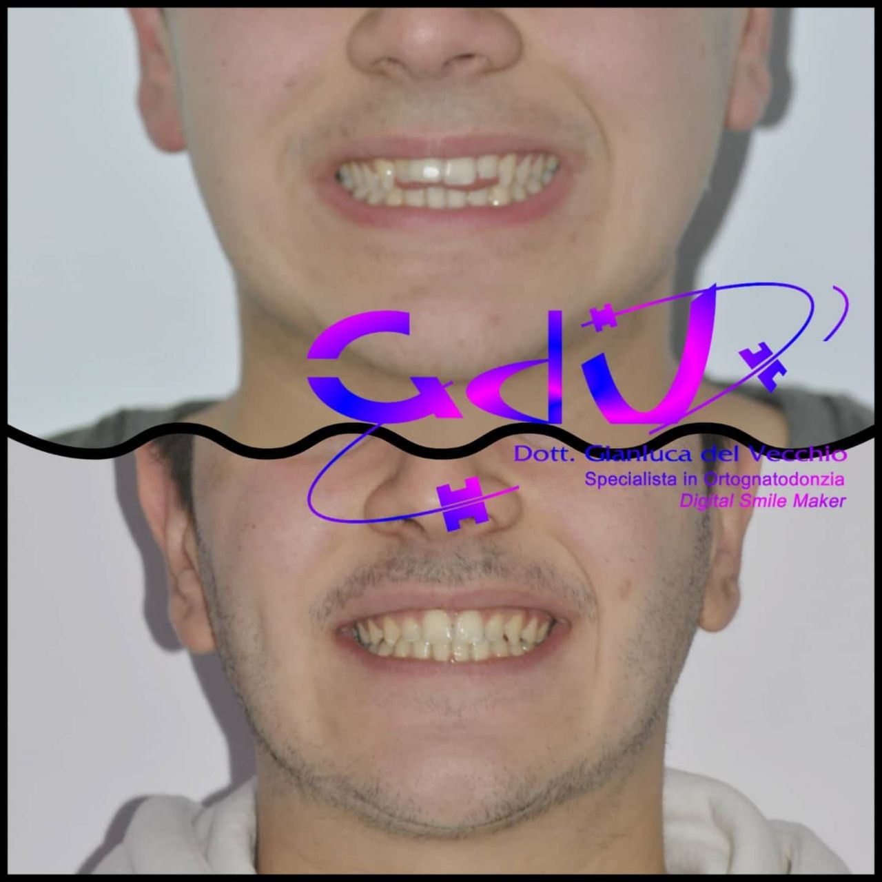 Gianluca Del Vecchio-161