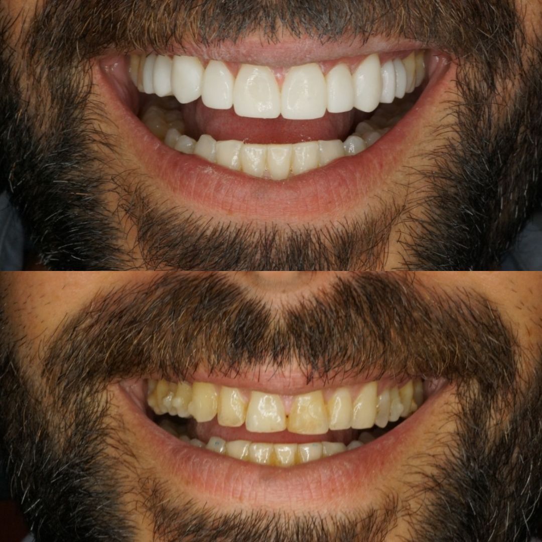 Raimonda Bogdanoviciute-23