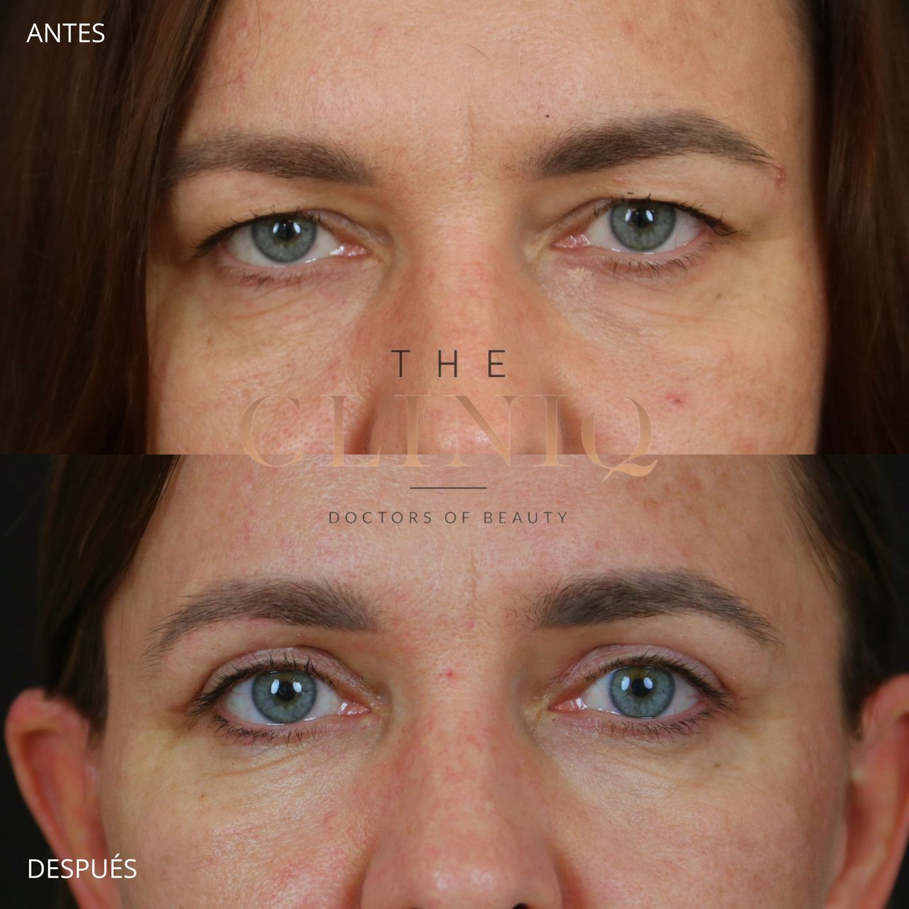 Ignacio Genol Saavedra-10