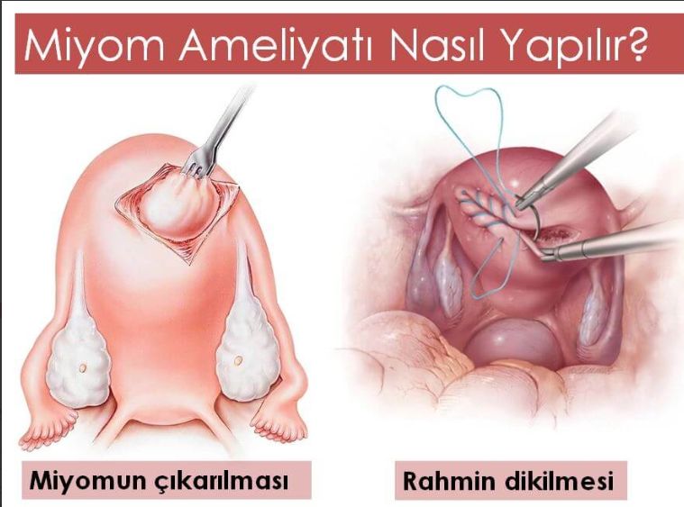 Türkan Saymaz İlhan-6
