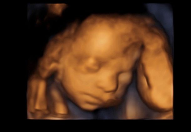 Tommaso Incandela-28