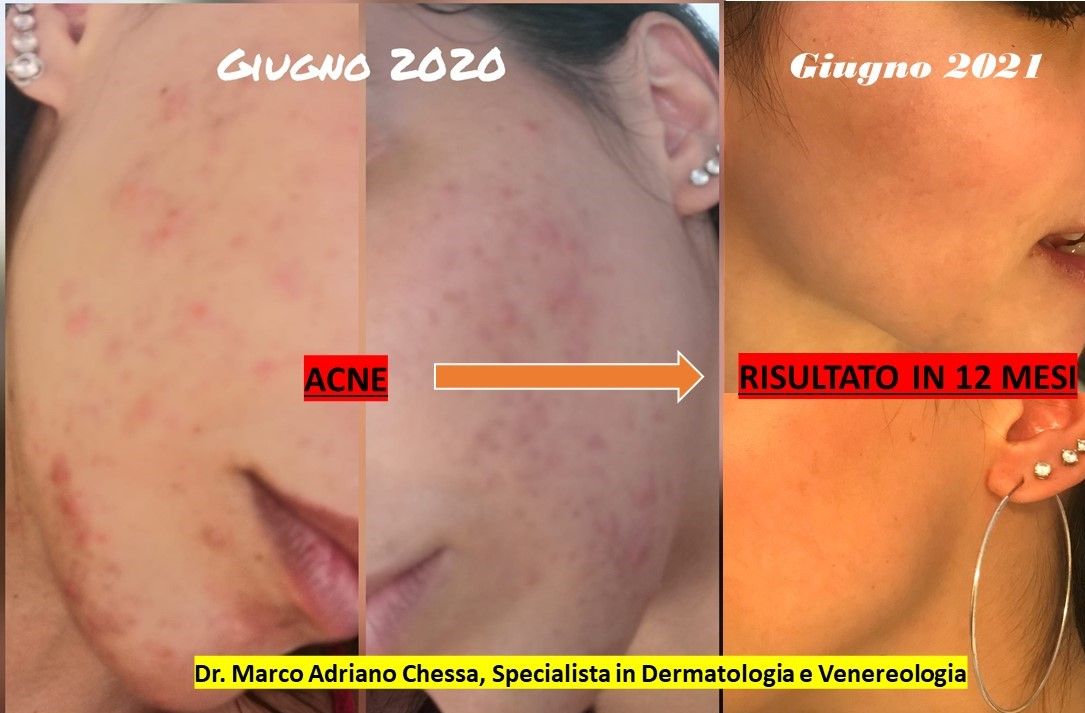 Marco Adriano Chessa-3