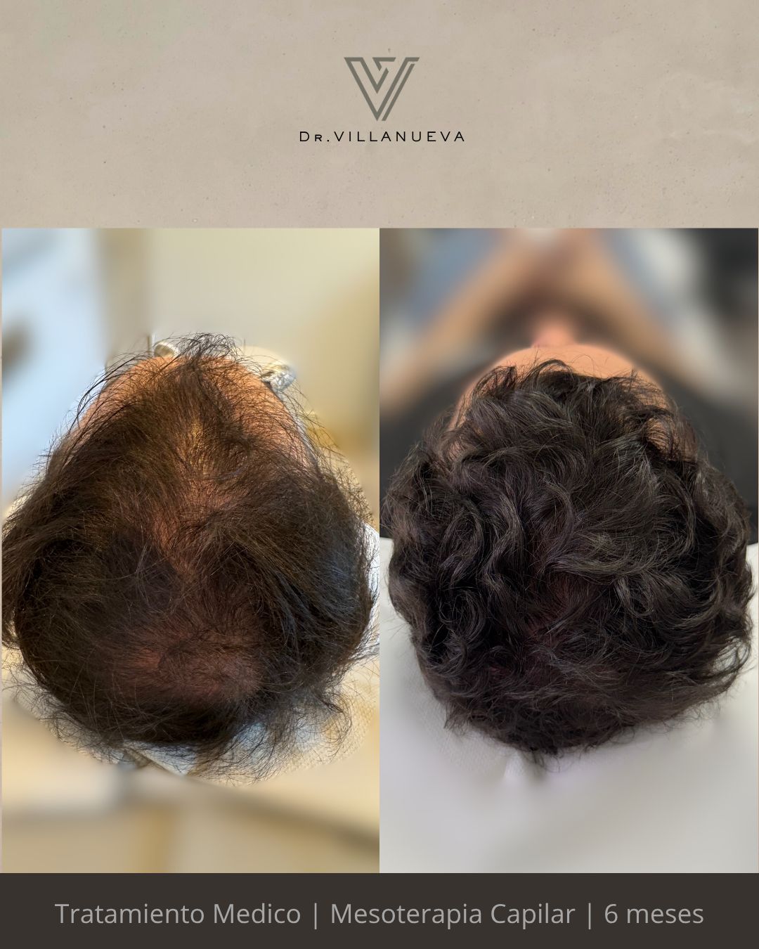 Alfredo Villanueva-16