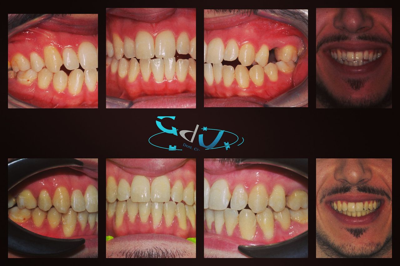 Gianluca Del Vecchio-115